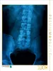 Calvendo Röntgenbild einer Lendenwirbelsäule. 1000 Teile Produktbild-Vorschau 3