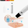 OKWISH Porenreiniger Electric ,Mitesserentferner ,EMS Produktbild-Vorschau 8