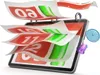 Lenovo Tab , 25,6 cm (10.1"), 1920 x 1200 Pixel, 128 GB, 4 Produktbild-Vorschau 7