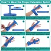 Verstellbare Fingerschiene Für Schnappfinger 1 Stück, Produktbild-Vorschau 7