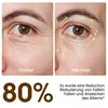 EMS Augenmassagegerät USB – Anti-Aging gegen Augenringe & Produktbild-Vorschau 6