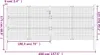 vidaXL Gartentor Anthrazit 400x125 cm Stahl Produktbild-Vorschau 7