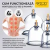 4FIZJO Vakuum-Saugglocken Set 12 Stück – Feuerlose Massage Produktbild-Vorschau 4