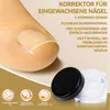 Eingewachsene Zehennägel Set 120 Stück Zehennagel Korrektur Produktbild-Vorschau 4
