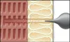 Abstandsmontagesystem ResiTHERM 16 galvanisch verzinkt Produktbild-Vorschau 3