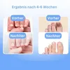 Nagelzubehör, Nagelpilz Reinigungslampe, Nagelpilz Laser Produktbild-Vorschau 2