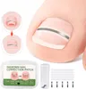 A close-up of a toe with an ingrown nail correction patch applied, along with a package of the patches and a tool. Anteprima dell’immagine prodotto