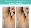 FOREO PEACH 2 IPL-Haarpflegegerät für glatte Haut – Sanfte Produktbild-Vorschau 6
