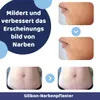 Paremmin Silikon Narbenpflaster Rolle 4 x 330 cm für Narben Produktbild-Vorschau 2