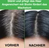 Haarpflege Haarwachstum Rosmarin Set Vegan: Shampoo+ Produktbild-Vorschau 8