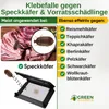 Speckkäfer Falle mit Pheromon-Lockstoff - 1x Falle -  Produktbild-Vorschau 2