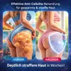 Vacuvia™ SculptGlow 4w1 Urządzenie do masażu Podgląd zdjęcia produktu 4