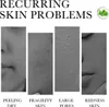 iUNIK Centella Calming Gel Cream, 60ml - Beruhigende und Produktbild-Vorschau 5