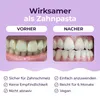 Sada pro bělení zubů OnlySmile – balení na 6 měsíců: 3x Náhled obrázku produktu 9