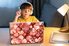 MuchoWow® Laptop Aufkleber Sticker Cover Abstrakt - Glitzer Produktbild-Vorschau 3