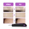 Kavitační ultrazvukový peelingový přístroj 2 v 1, Skin Náhled obrázku produktu 3