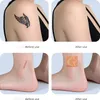 INF Innovatieve camouflagepleisters voor tatoeages en Productafbeelding-voorbeeld 4