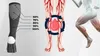 FIT4MED | CALZE A COMPRESSIONE CALZE AL GINOCCHIO CALZE A Anteprima dell’immagine prodotto 13