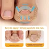 Teennagelcorrectiepleisters, 110 stuks, ademend, Productafbeelding-voorbeeld 4