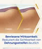 NIVEA 98948 NIVEA LUMINOUS630® ANTI-DEHNUNGSSTREIFEN Náhled obrázku produktu 5
