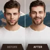 Bartwuchsöl für Herren – Vanille Produktbild-Vorschau 7