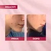 Biotrade Acnaut Crema Attiva per pelli grasse e acneiche Anteprima dell’immagine prodotto 4