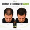 Ricinusolie Shampoo met Biotine voor Sterker en Groeiend Productafbeelding-voorbeeld 5