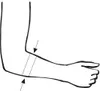 Bort Ellenbogen-Polster-Bandage Produktbild-Vorschau 1