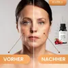 Hagebuttenöl, Kaltgepresst, 100% Rein, BIO, natürlich, 30 Produktbild-Vorschau 3