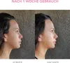 FOREO BEAR mini Smartes Mikrostrom-Gesichtsgerät für Produktbild-Vorschau 4