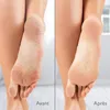 A split image showing a comparison of a person's heel before and after using a product. Produktbild-Vorschau