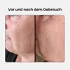 A split image showing a person's face before and after using a product, highlighting skin improvements. Produktbild-Vorschau