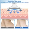 Ice Gesichtsmassagegerät Anti-Falten, EMS LED Farbtherapie, Produktbild-Vorschau 4