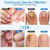 Collage of before and after images showing nail fungus treatment results. Voir les images du produit