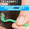 ZECKENFIX Zeckenzange Hunde Katze Zeckenpinzette Produktbild-Vorschau 4