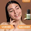 Teebaumöl, ätherisches Öl, 100% Rein, BIO, natürlich, 10 ml Produktbild-Vorschau 4