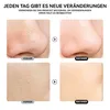 Mitesserentferner Gesichtspflegegerät, Sonstige Produktbild-Vorschau 6
