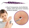 Pinza professionale per zecche Helperfect 2 in 1 - per cani Anteprima dell’immagine prodotto 4