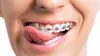 Gum | Zahnpasta - Zahnpasta Für Zahnspangen Gum Ortho - 75 Produktbild-Vorschau 6