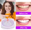 Dental Polierstreifen, 50um Dicke Zahnfeile Dental Produktbild-Vorschau 2