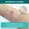 Pansement hydrocolloïde Pansement adhésif Rouleau Voir les images du produit 6