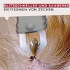 Fackelmann Zeckenzange für Menschen und Haustiere, Produktbild-Vorschau 3