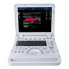 Échographe portable avec sonde linéaire Doppler couleur Voir les images du produit 10