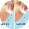 Scholl 3071633, Schwarz, 1 Stück(e) Produktbild-Vorschau 4