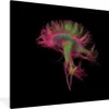MuchoWow® Gerahmtes Poster MRI-Scan 40x40 cm - Poster mit Produktbild-Vorschau 1