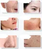 Anlan Ultrasonic facial massager with light therapy ANLAN Produktbild-Vorschau 5