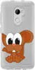 PhoneNatic Case kompatibel mit HTC One X10 Silikon-Hülle Produktbild-Vorschau 2