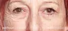 My Perfect Eyes – Augencreme – 10 g Produktbild-Vorschau 13
