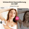 IPL Laser Haarentfernung 990.000 Lichtimpulse – Schmerzfrei Produktbild-Vorschau 9