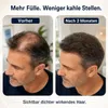 HaloGrow™ Haarwuchs Spray Haarwachstumsspray Produktbild-Vorschau 4